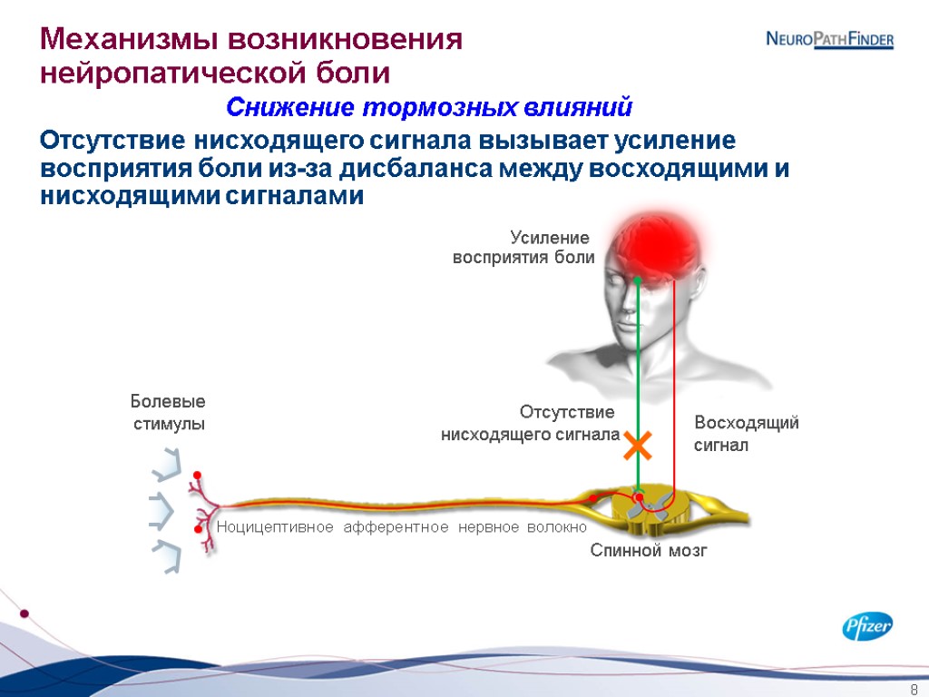 8 Механизмы возникновения нейропатической боли Снижение тормозных влияний Восходящий сигнал Отсутствие нисходящего сигнала Усиление